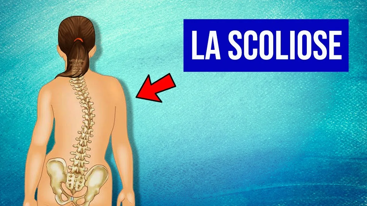 Révolution en Franche-Comté : une IA transforme la lutte contre la scoliose chez les jeunes !